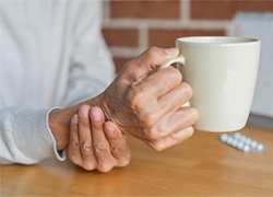 Arthritis in the Hands: When Non-Surgical Treatments Aren’t Enough
