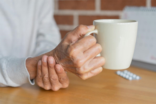 Arthritis in the Hands: When Non-Surgical Treatments Aren’t Enough